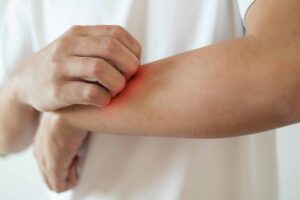 From Mild to Medical: When Your Rash Demands Professional Care 1 Rashes